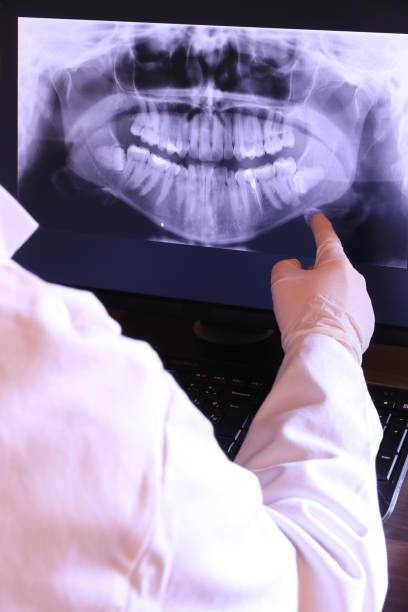 Best Emergency Treatment for Oral Infections in White Plains, NC