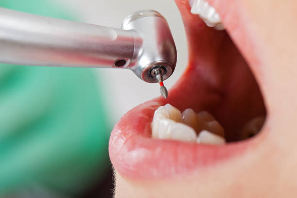 Best Emergency Care for Gum Disease in White Plains, NC